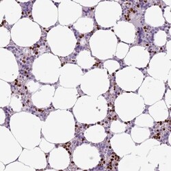 BRUNOL6 Antibody, Novus Biologicals 0.1mL; Unlabeled:Antibodies, Polyclonal